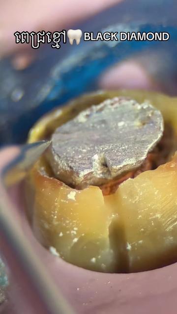 @ដុកទ័រធ្មេញ សុខហេង - Dokter