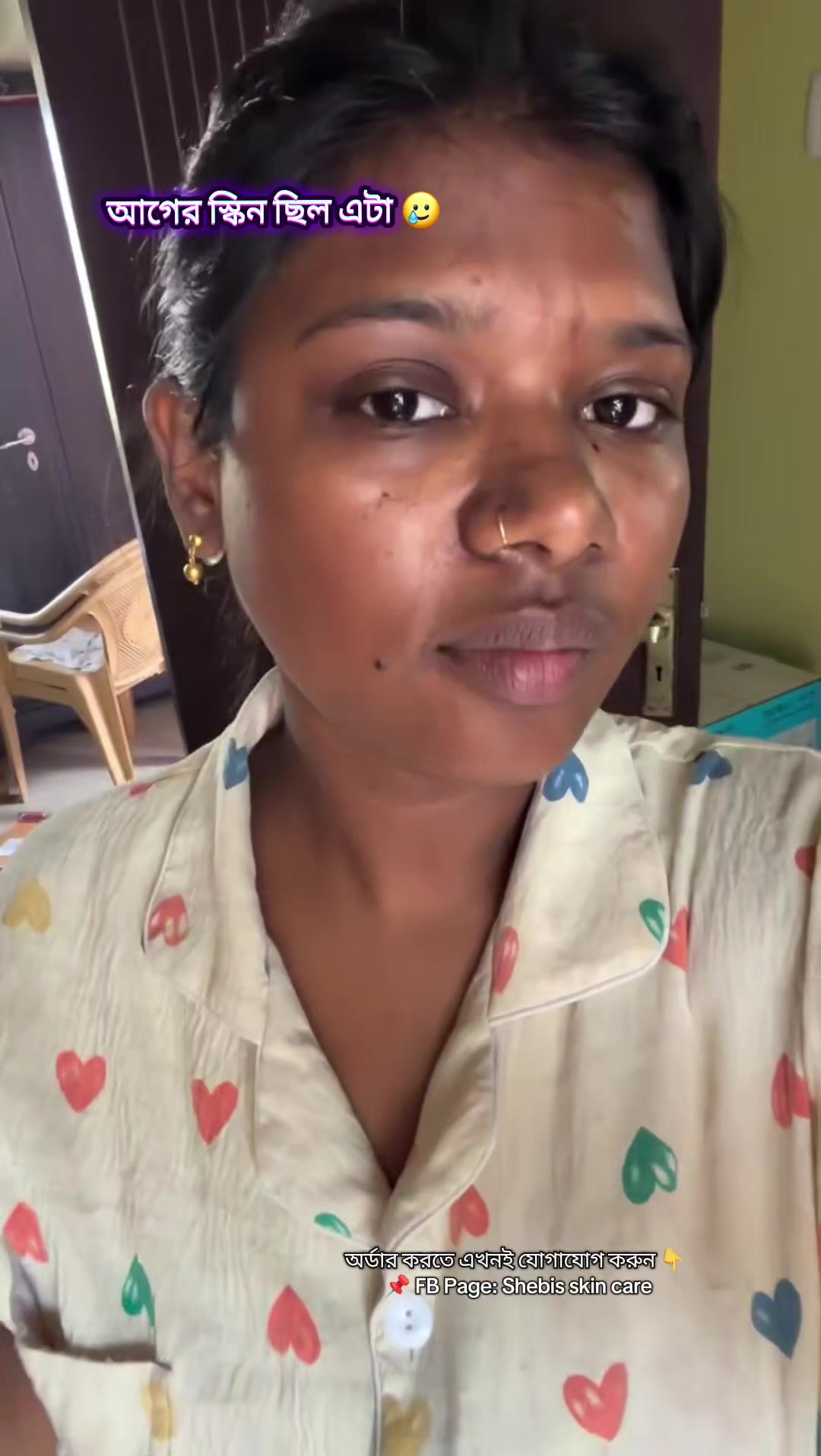 @Shebis skin care