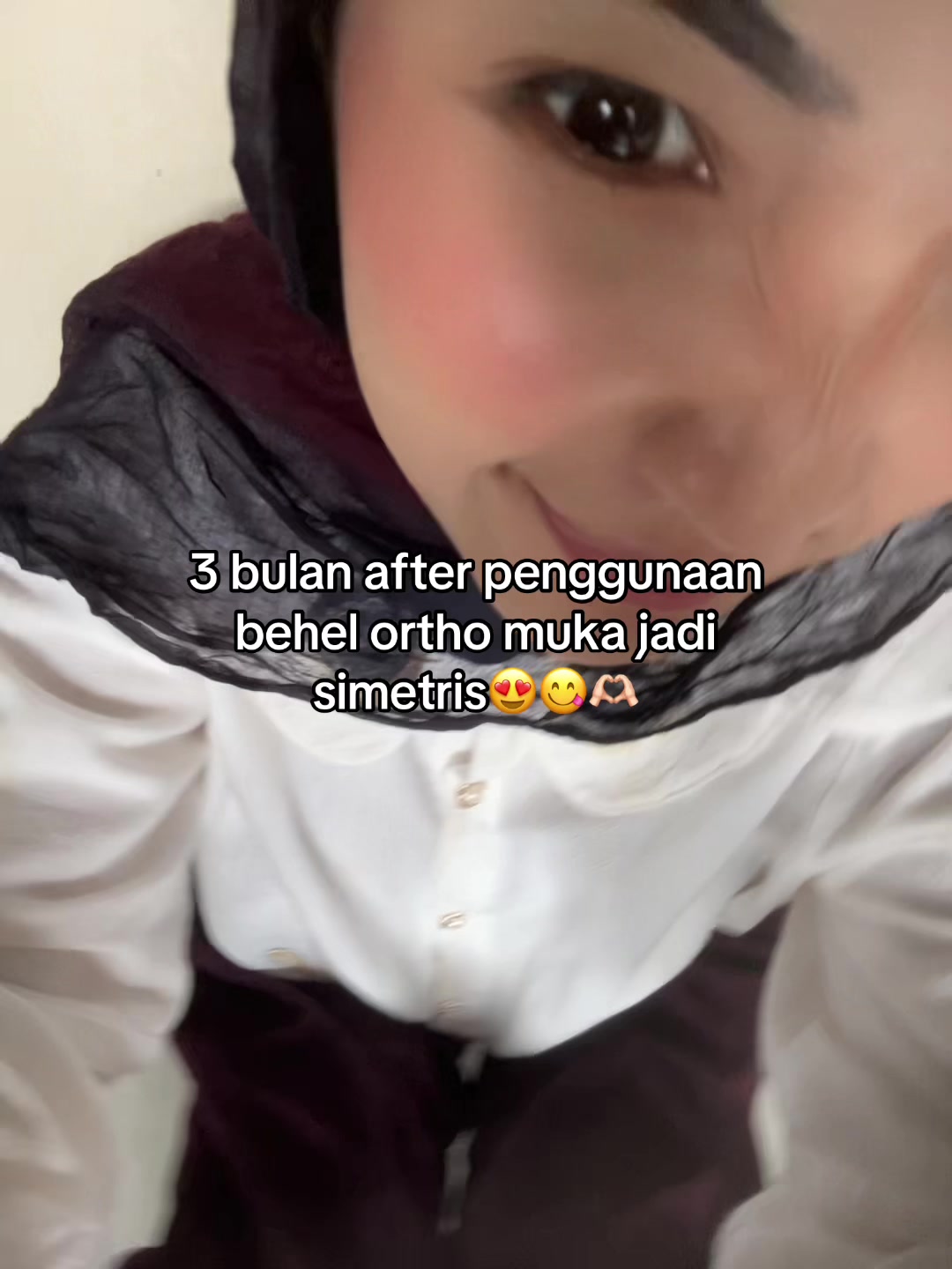 @ranunaaz