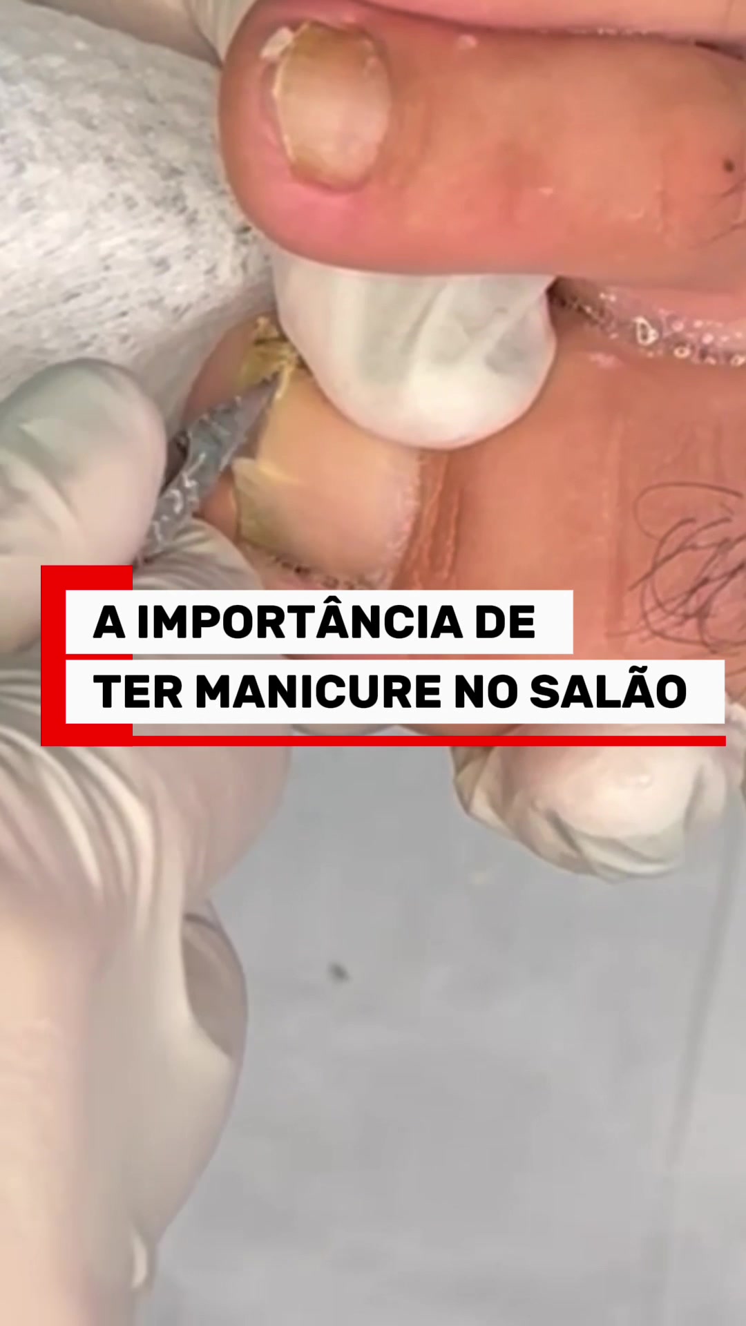 @Podocurebr