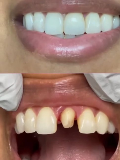 @Tech Dental