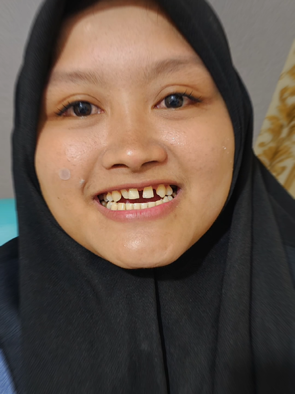 @Fiqygigi