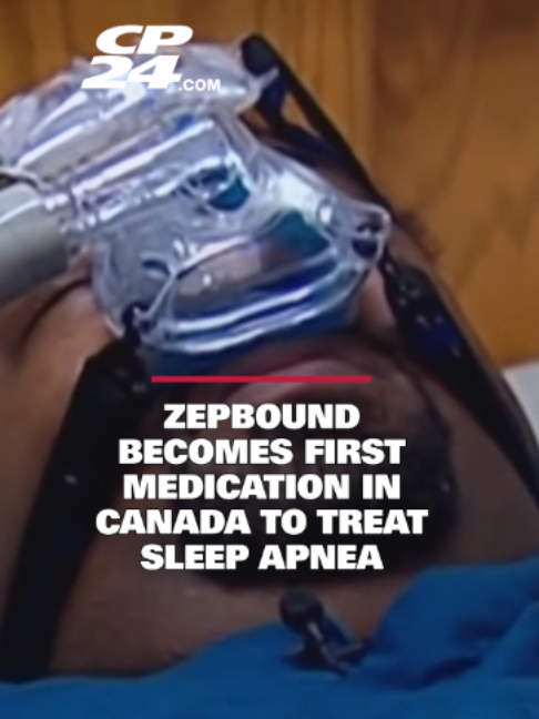 @cp24