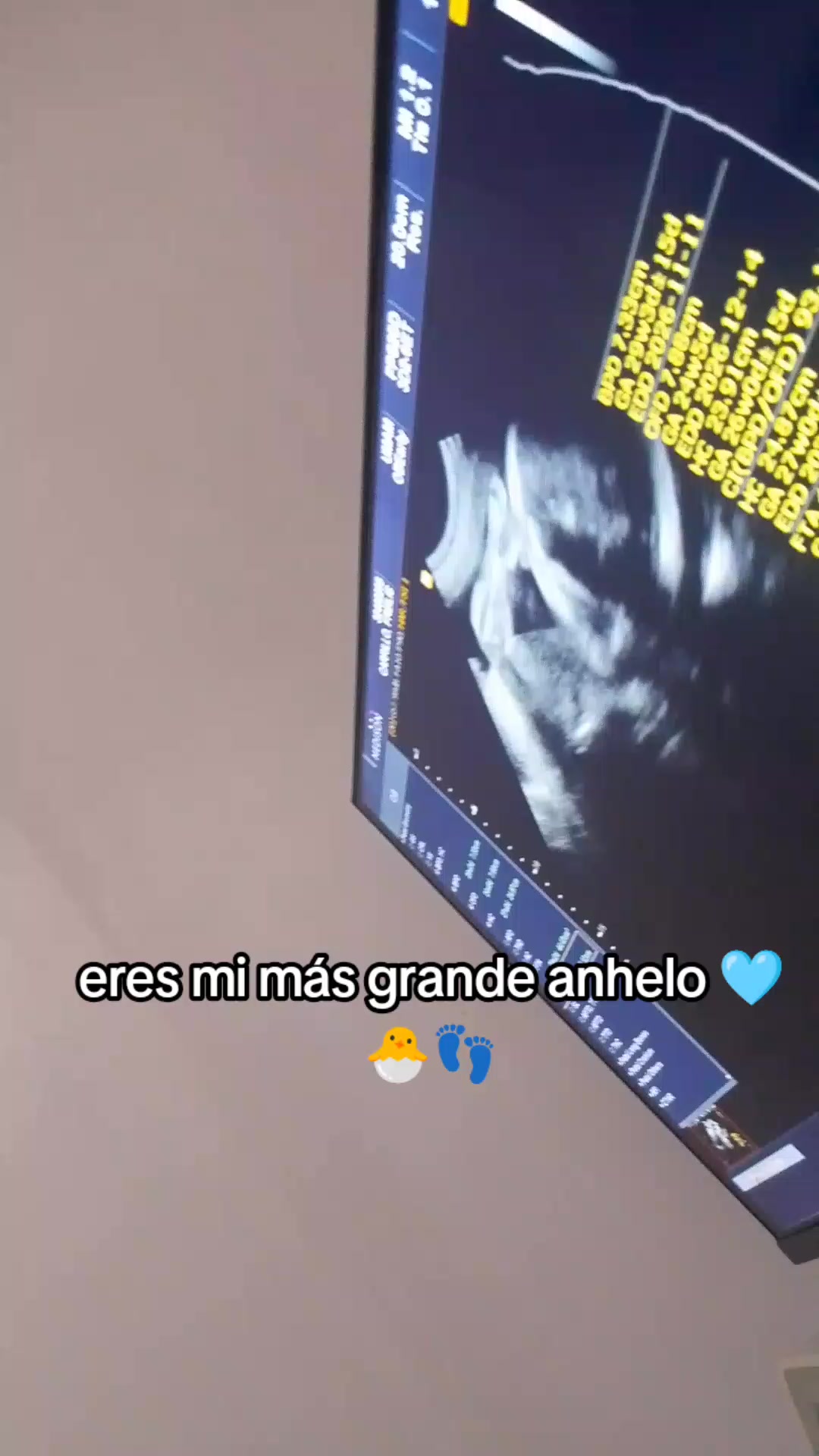 @️freilis
