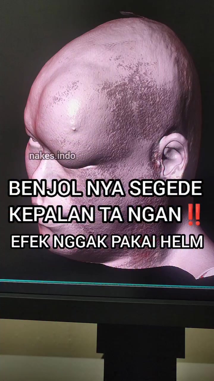 @Sobat Radiology