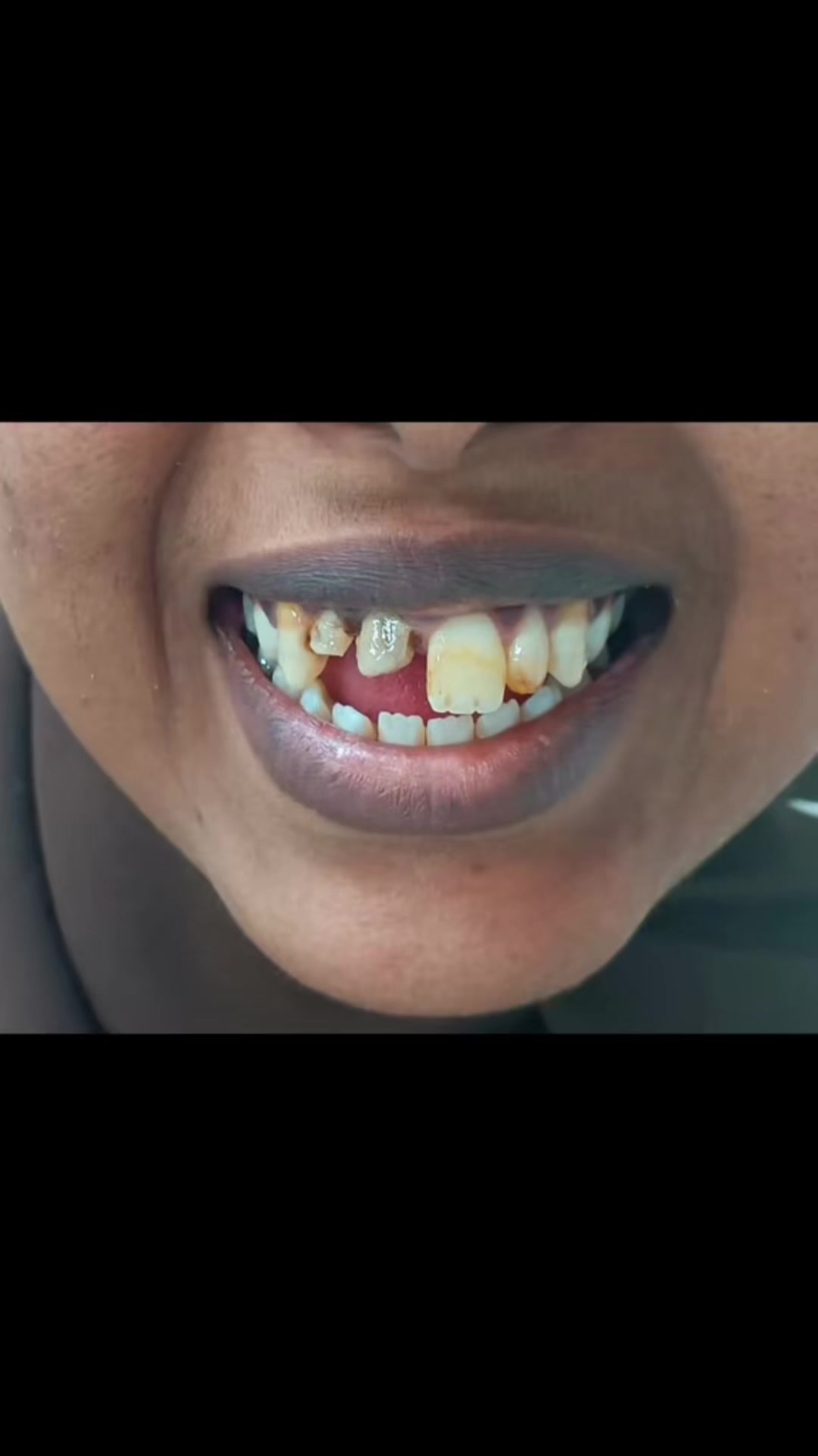 @Family Dental Clinic -Hargeisa