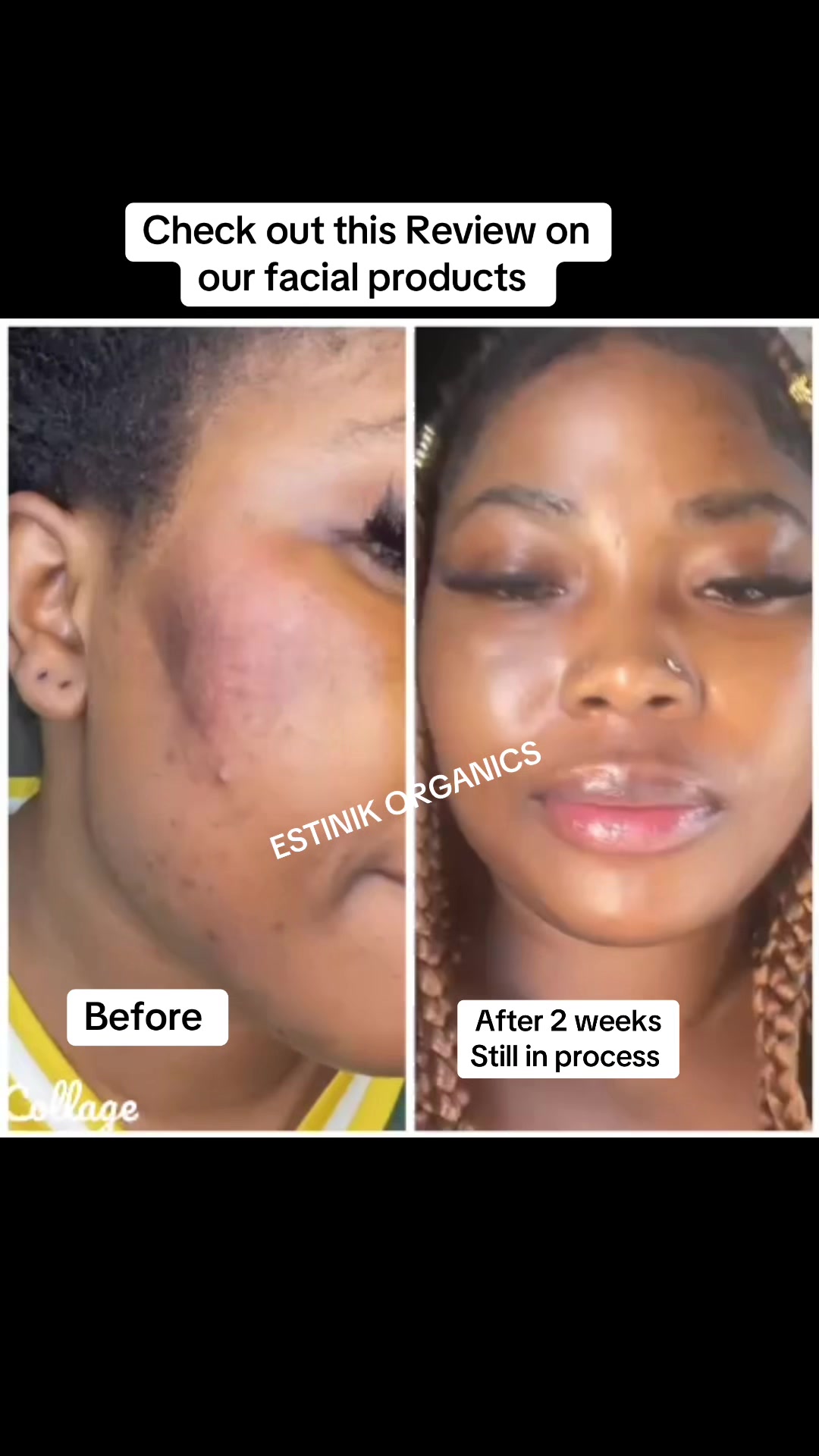 @EstinikBeautySecrets