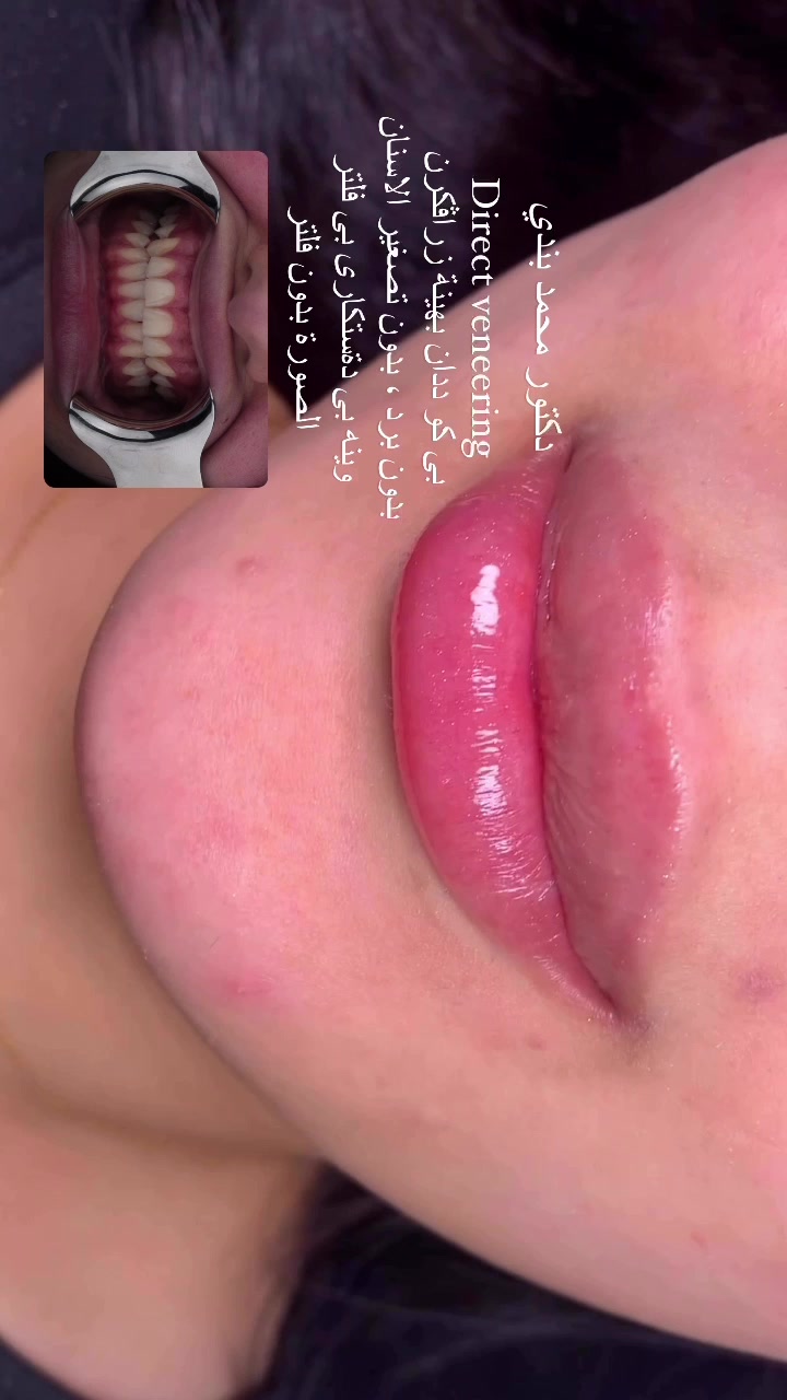 @Dr.Mohammed.Bandi