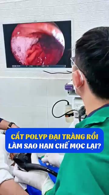 @Nội Soi Ti&ecirc;u H&oacute;a Cần Thơ