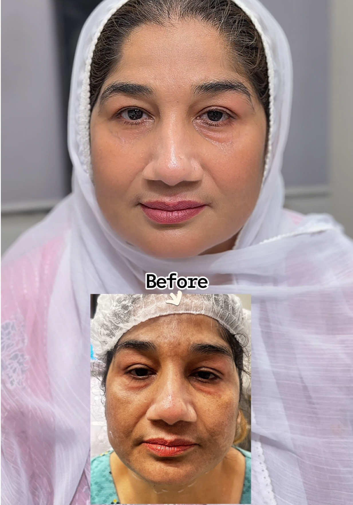 @MR Aesthetics ๐ 0325 9611110