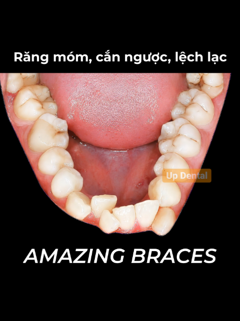 @Nha khoa niềng răng Up Dental