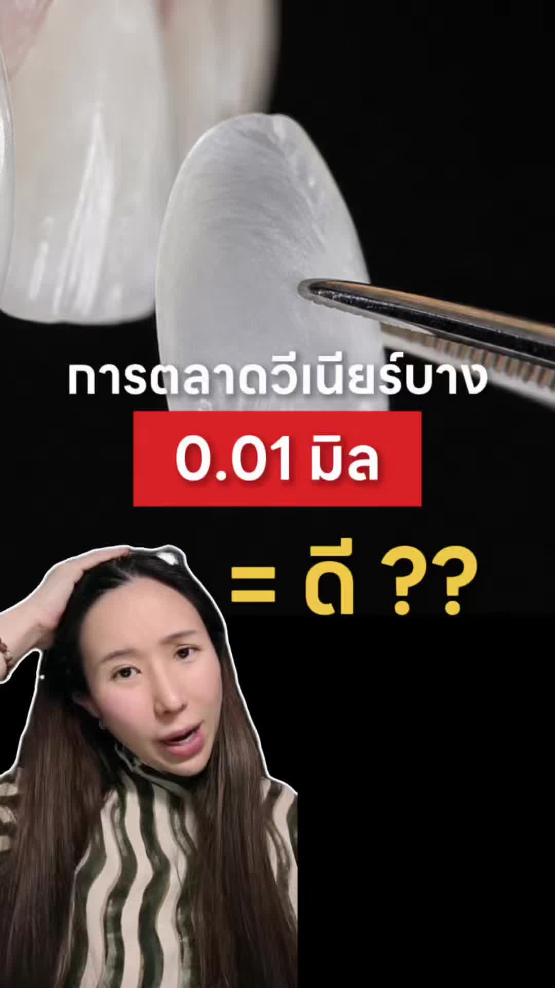 @หมอป่องสวยมาก veneer 🦷