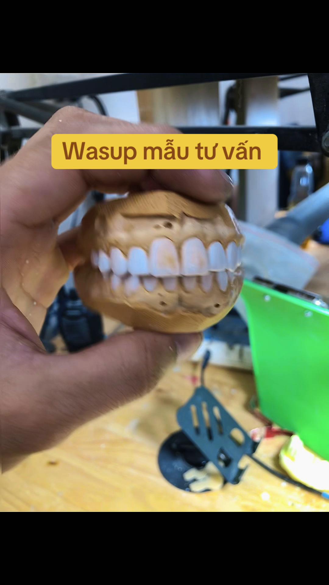 @Hùng răng sứ 🦷🦷