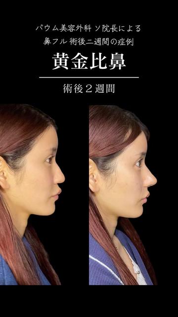 @ソ院長(バウム美容外科/トータル整形)