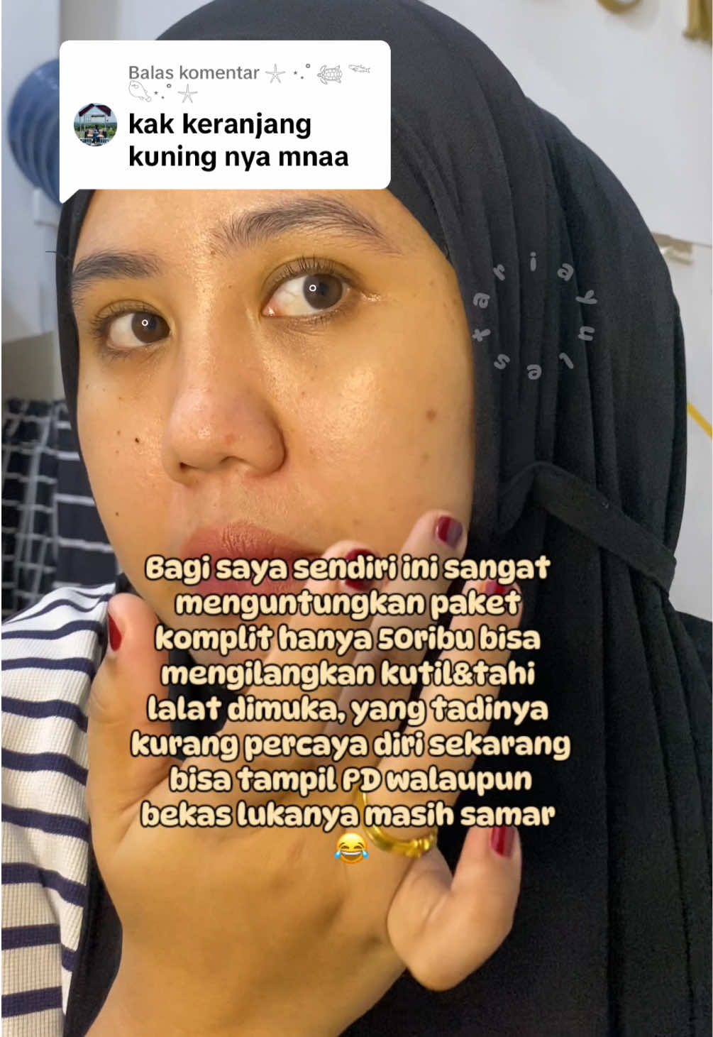 @Penghilangtahilalat.kaq.ay