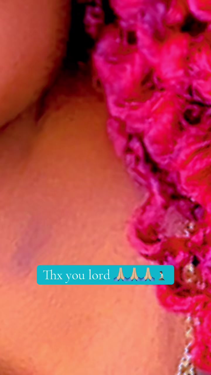 @Miss Derrick Omu bwati ๐๐