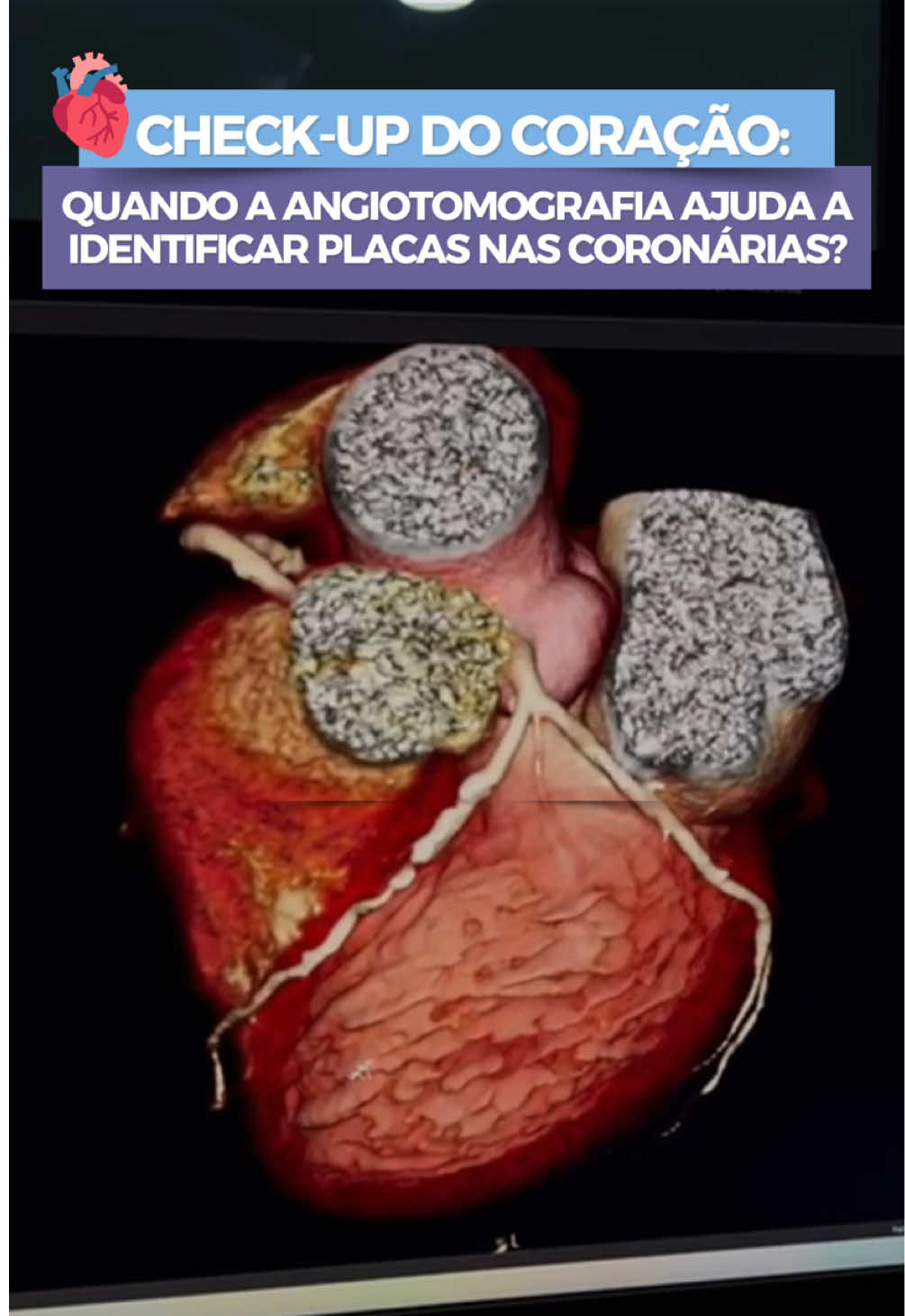 @Mega Imagem