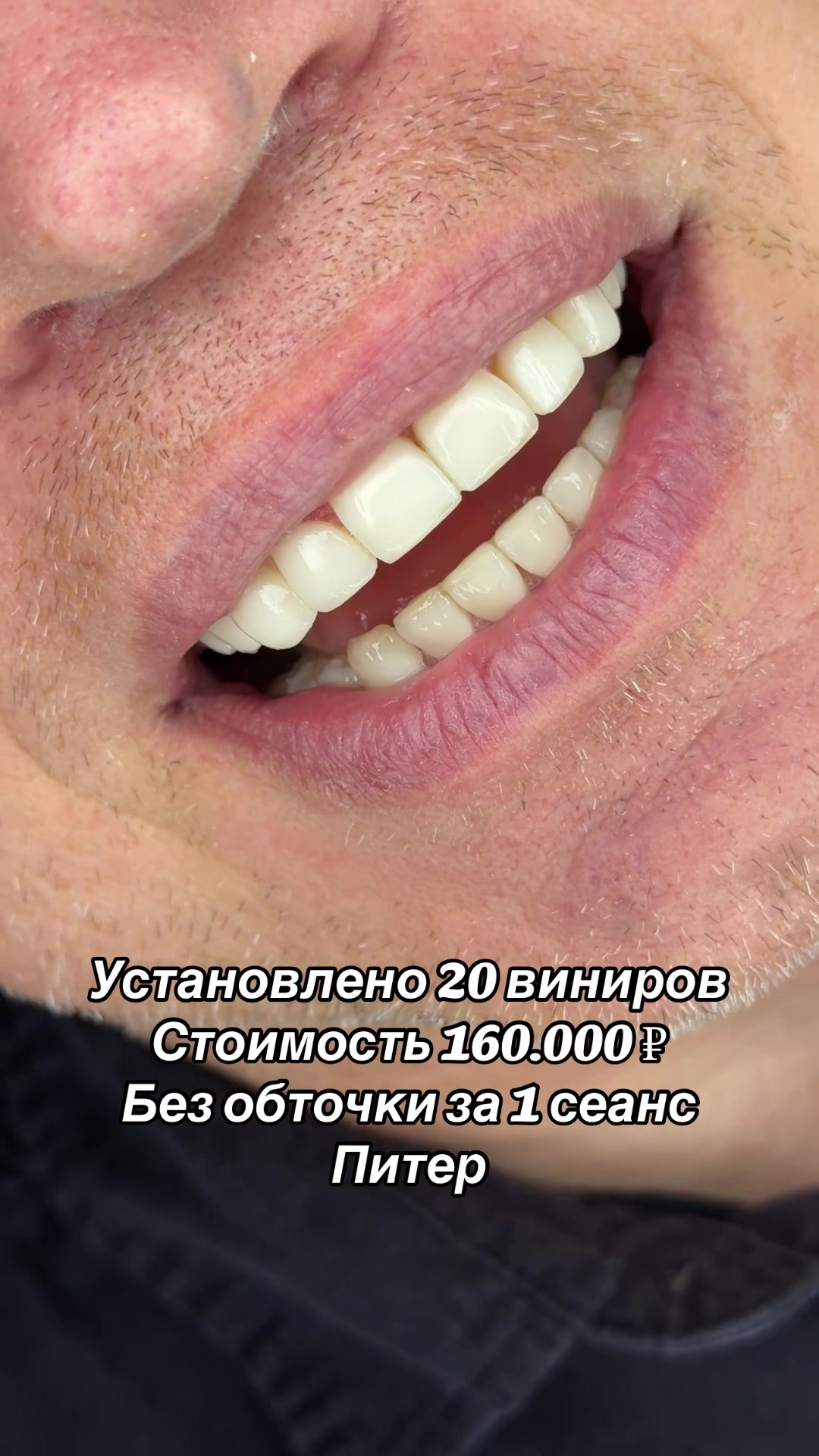 @Royal_smile_moscow