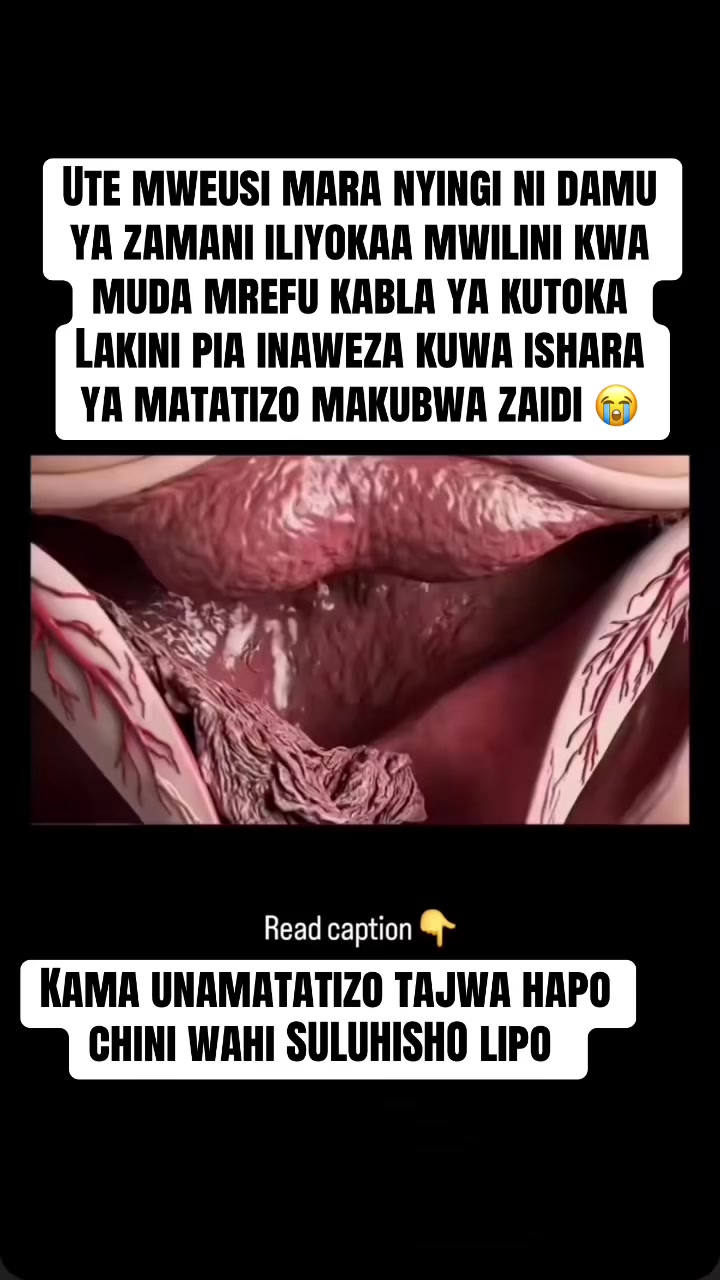 @Madam Zellah