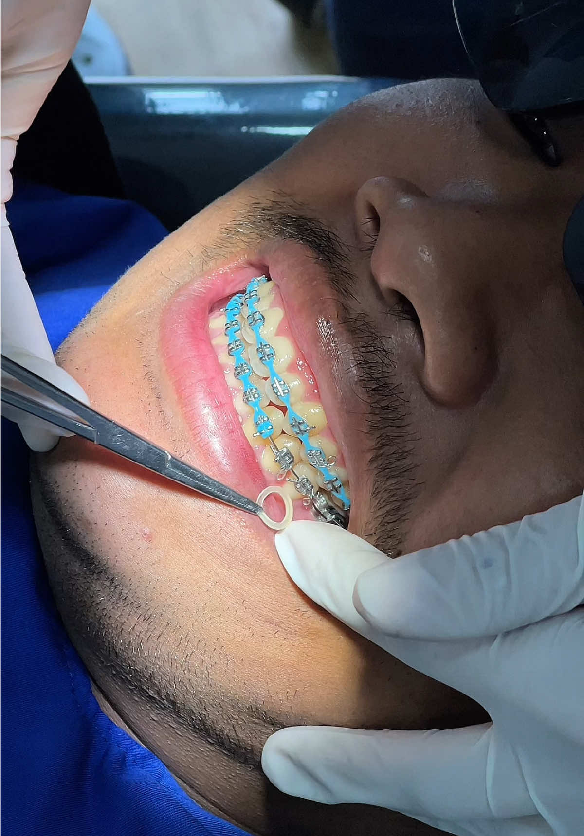 @BRIGHT SMILE DENTAL HOSPITAL