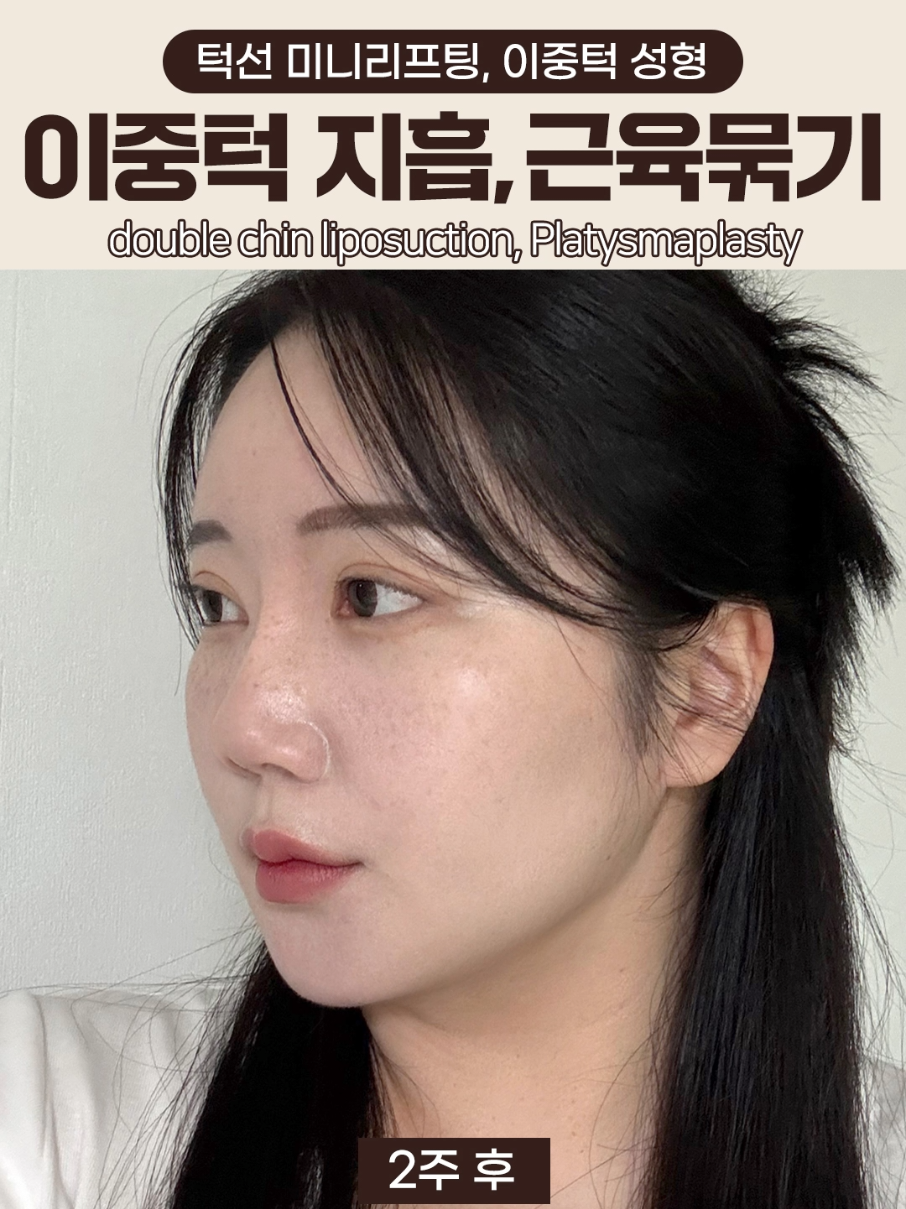 @차민성형외과의원