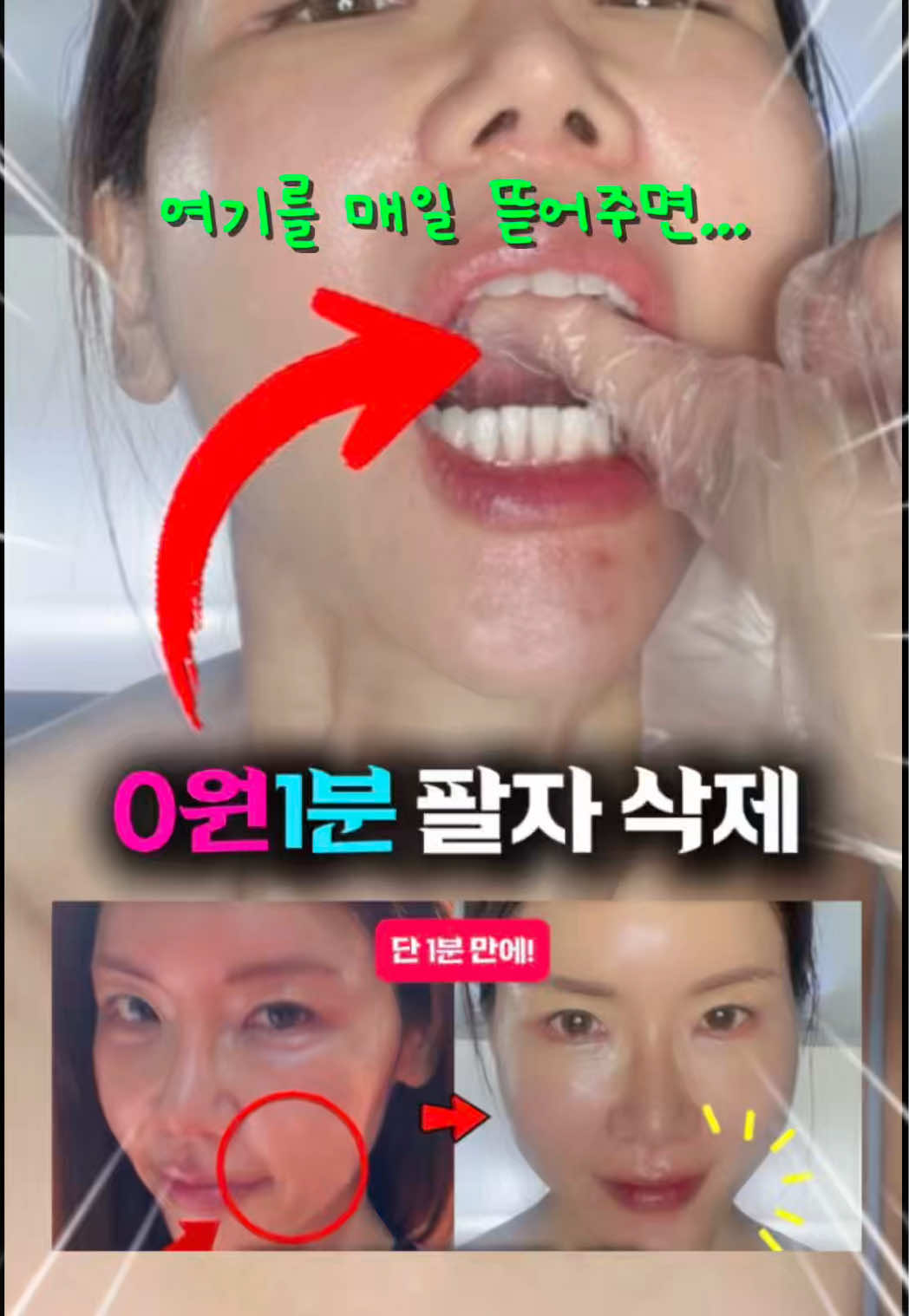 @지나스 GINAS