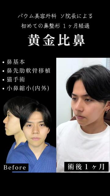 @ソ院長(バウム美容外科/トータル整形)