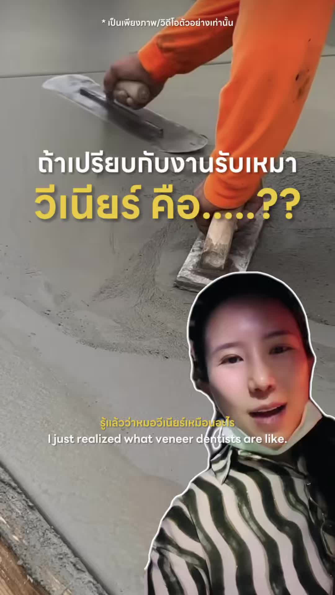 @หมอป่องสวยมาก veneer 🦷