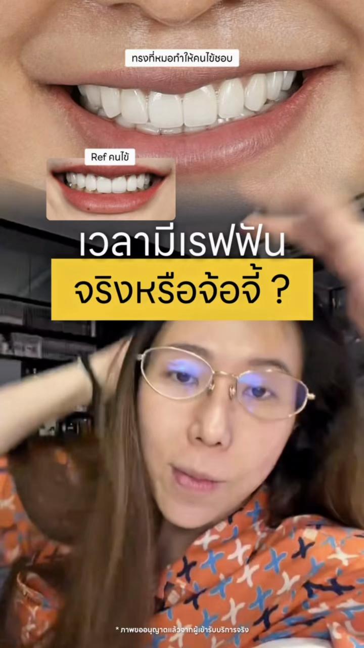 @หมอป่องสวยมาก veneer 🦷