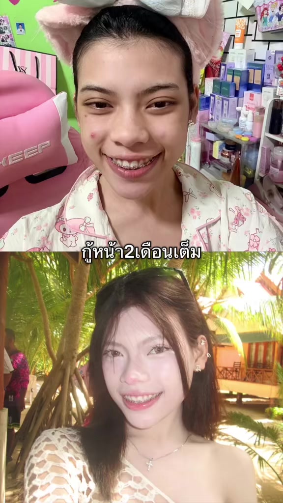 @น้องแพรชอบกินทาร์ตไข่..(400.k)