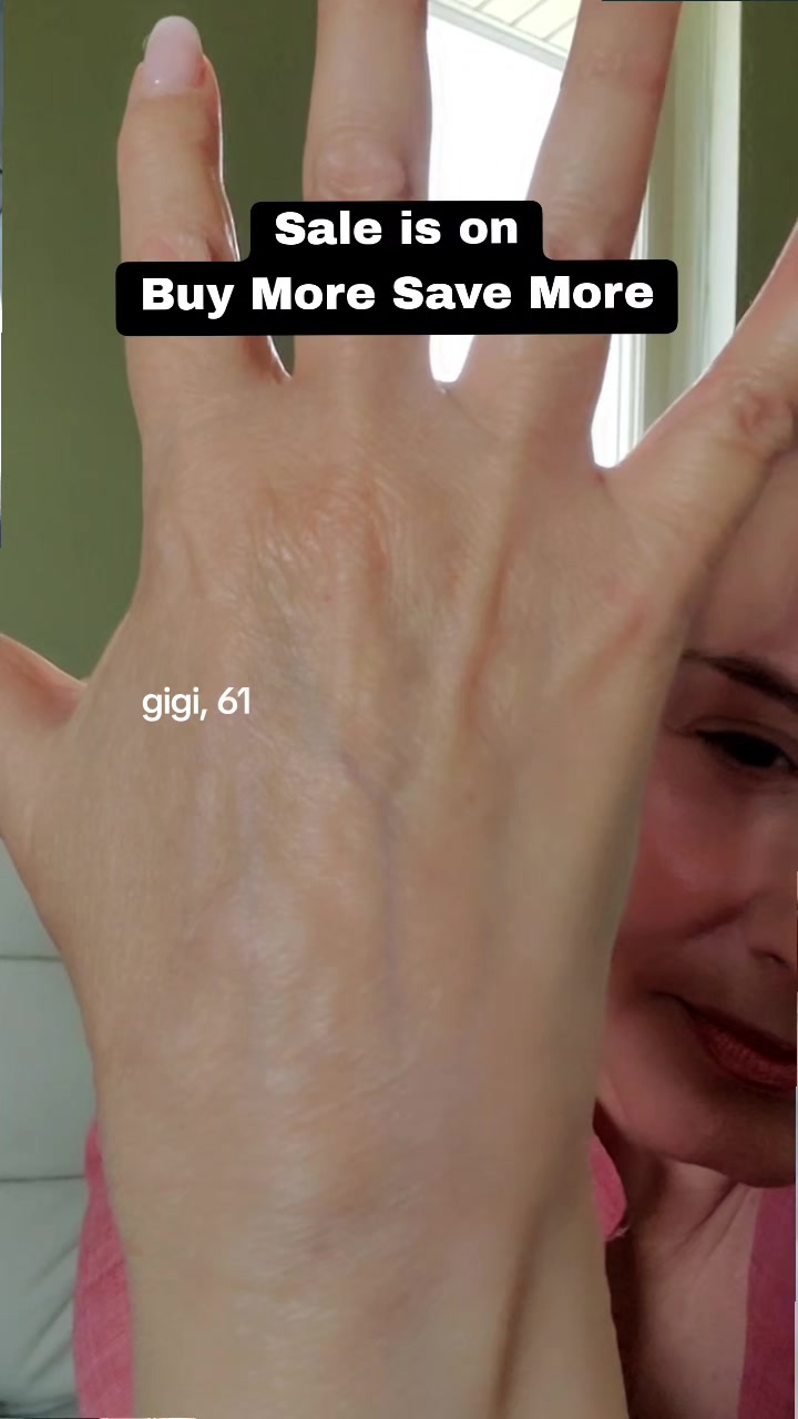 @Gigi