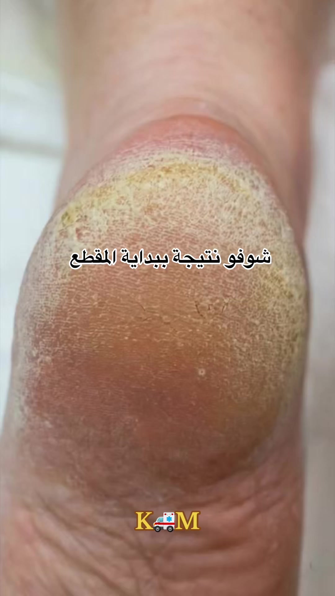 @khaled.MTMT