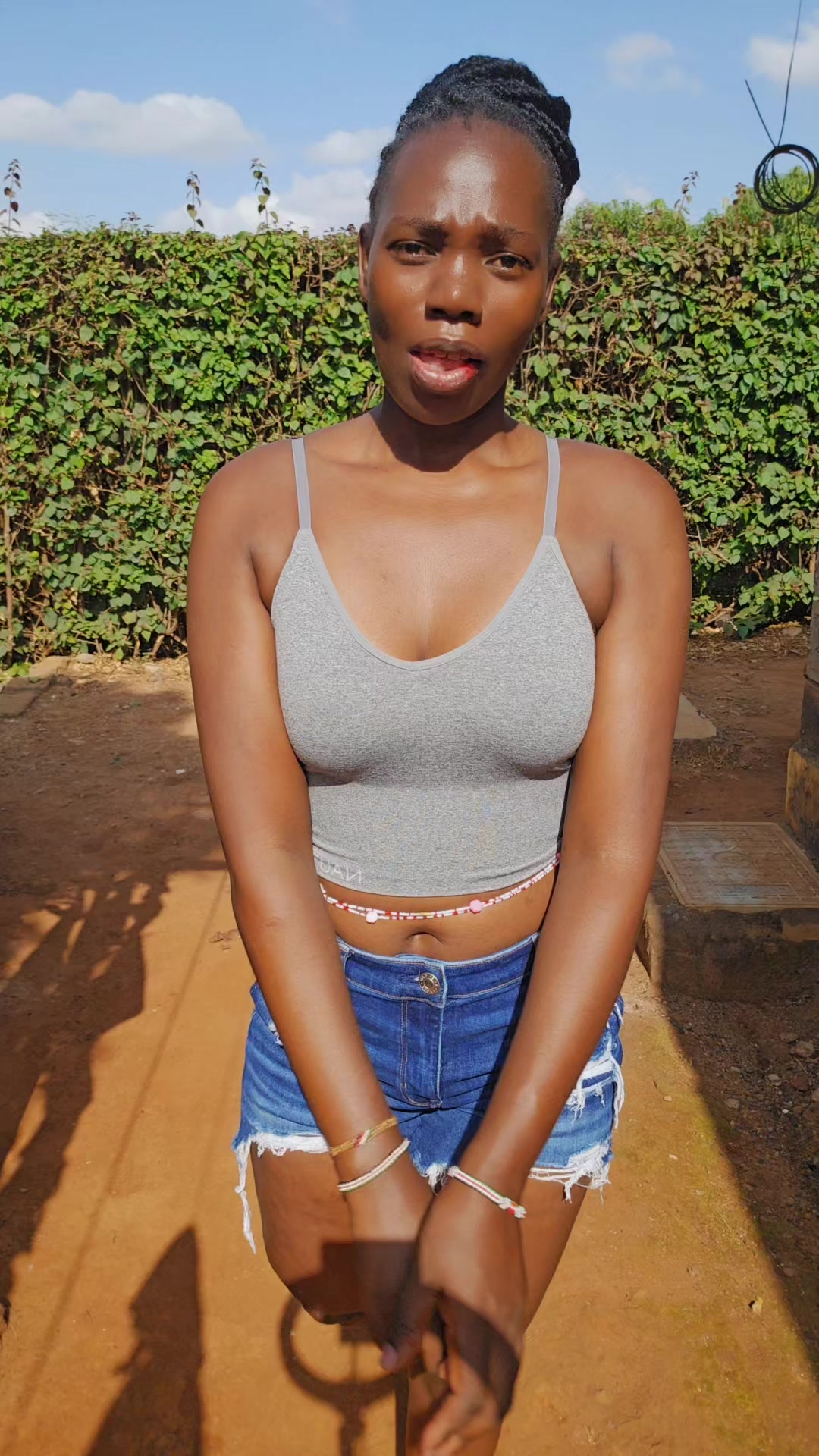 @💎Nattie Amputee🇰🇪♊️