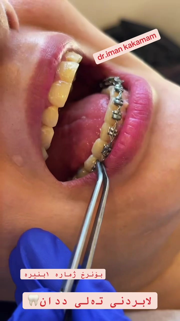 @🦷 دکتۆرە ئیمان کاکەمەم