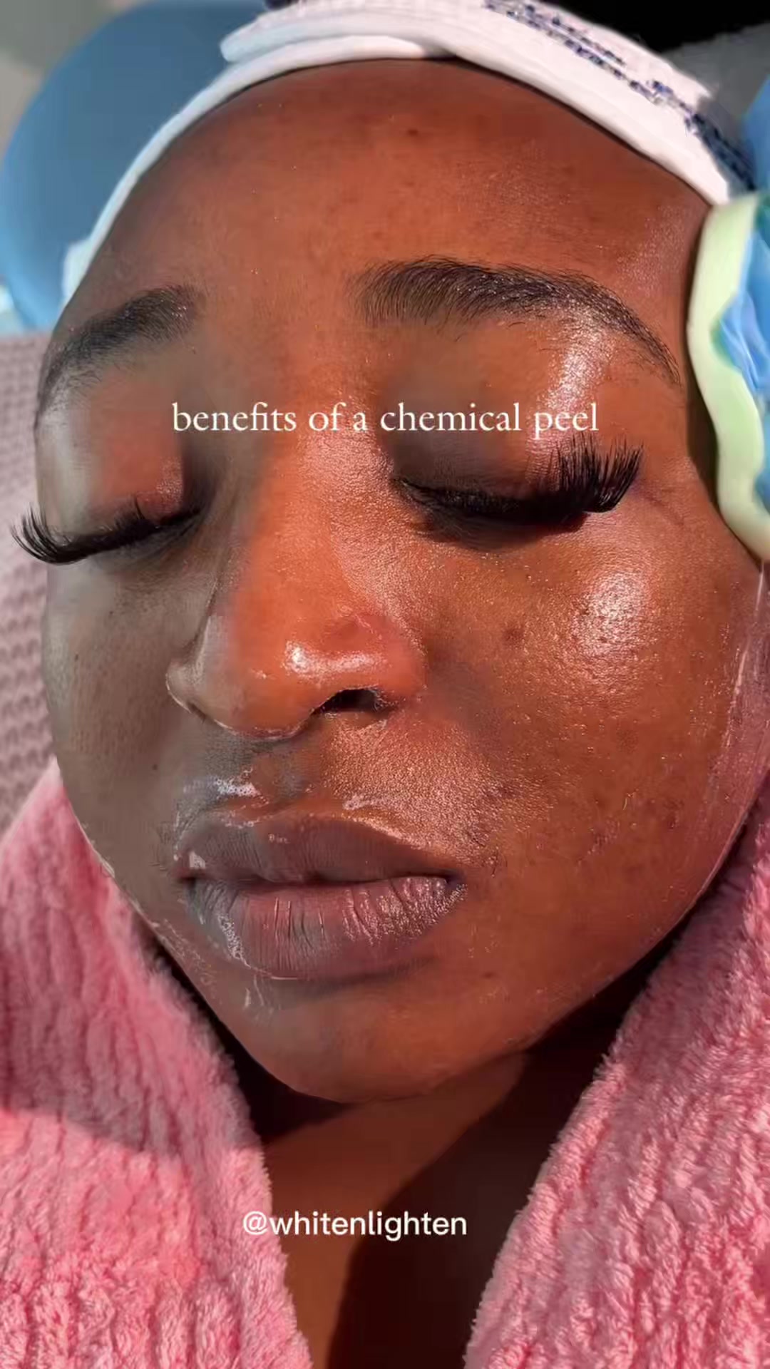 @Whiten Lighten TAC