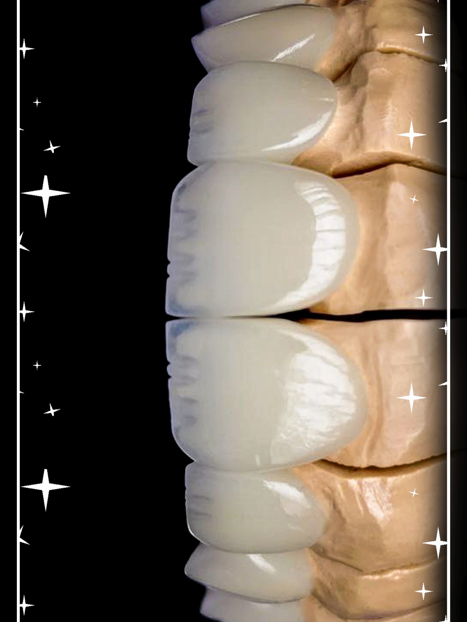 Micro Dental Lab (@microdents) - Urlebird