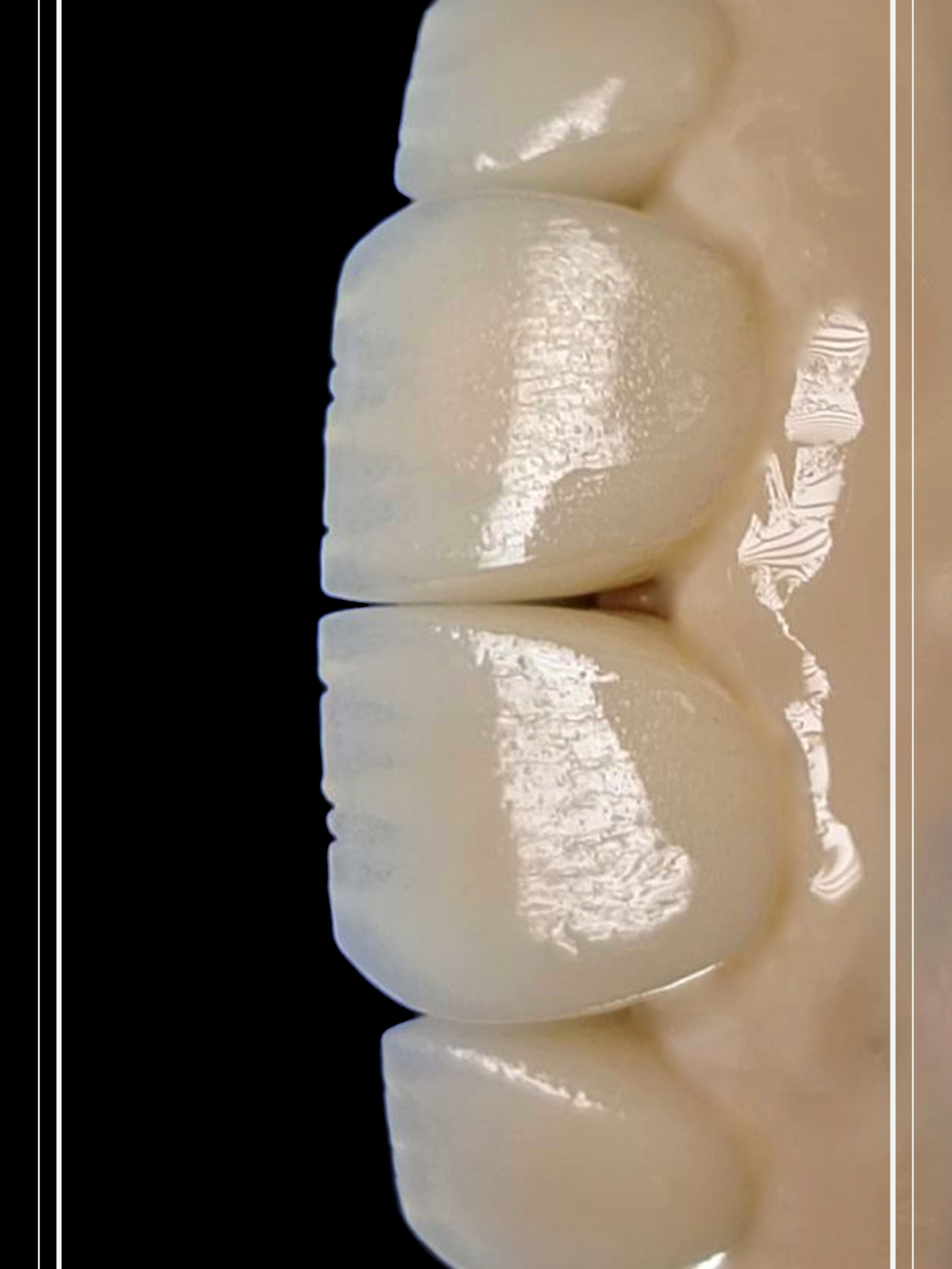 Micro Dental Lab (@microdents) - Urlebird