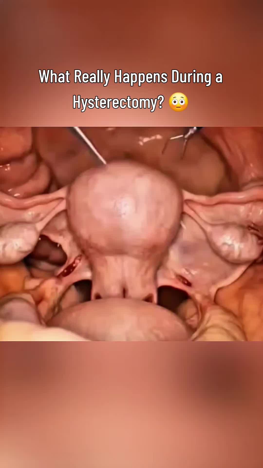 @femniverse 3