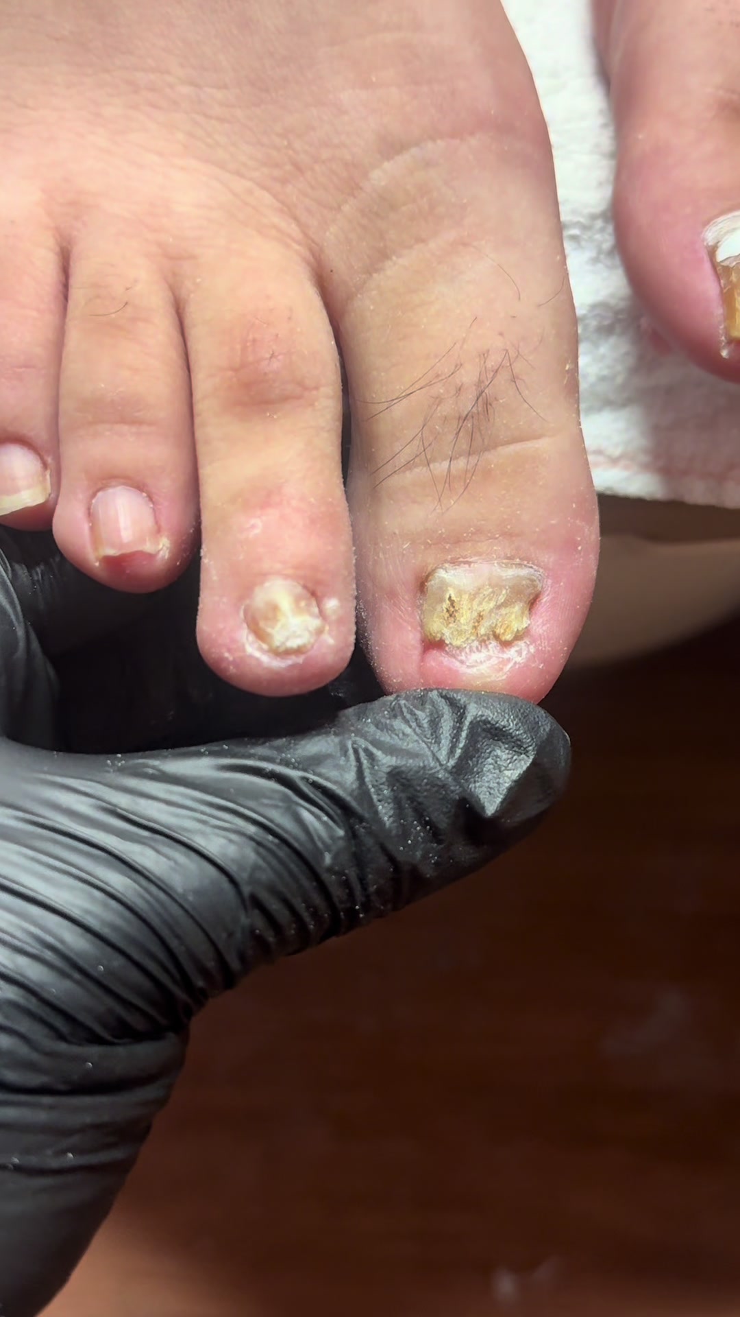 @ToesbyKoki