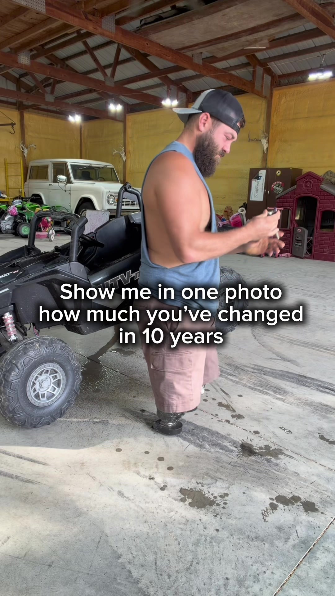 @Limb Loss Boss