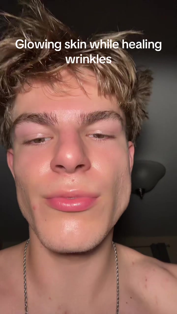 @Finn