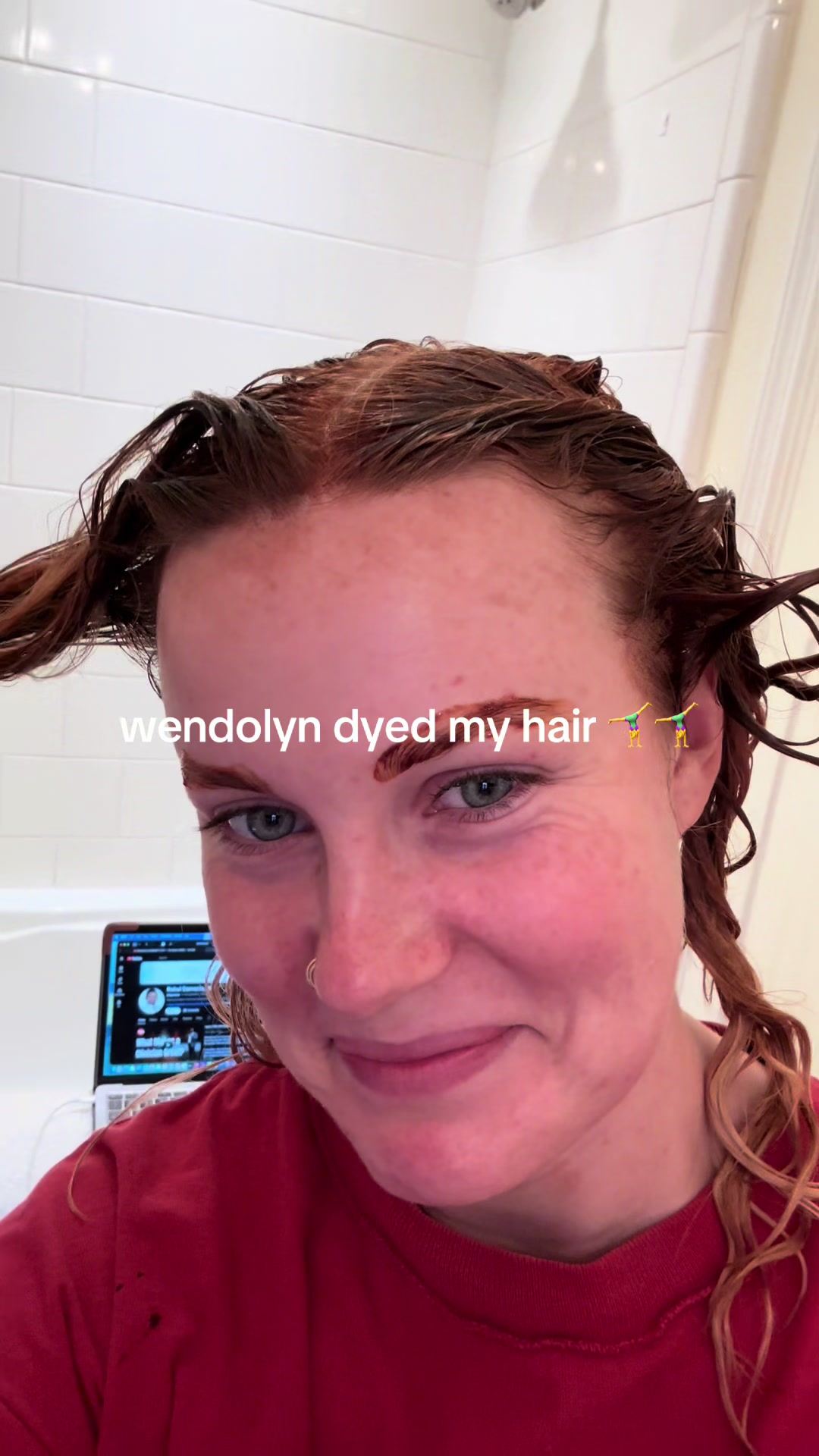 @hollyn🐞- OMS IV