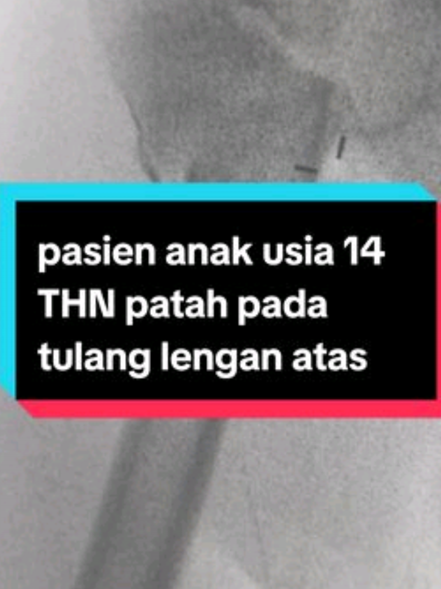 @KAMAR OPERASI