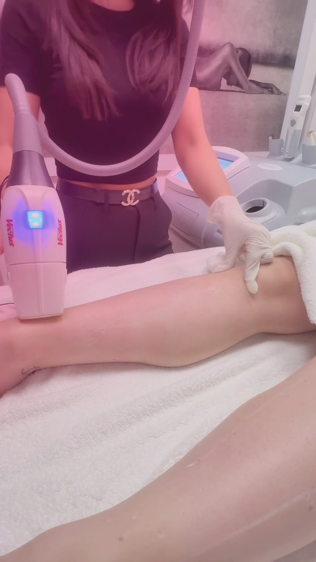 @Fatma Laser D&uuml;sseldorf