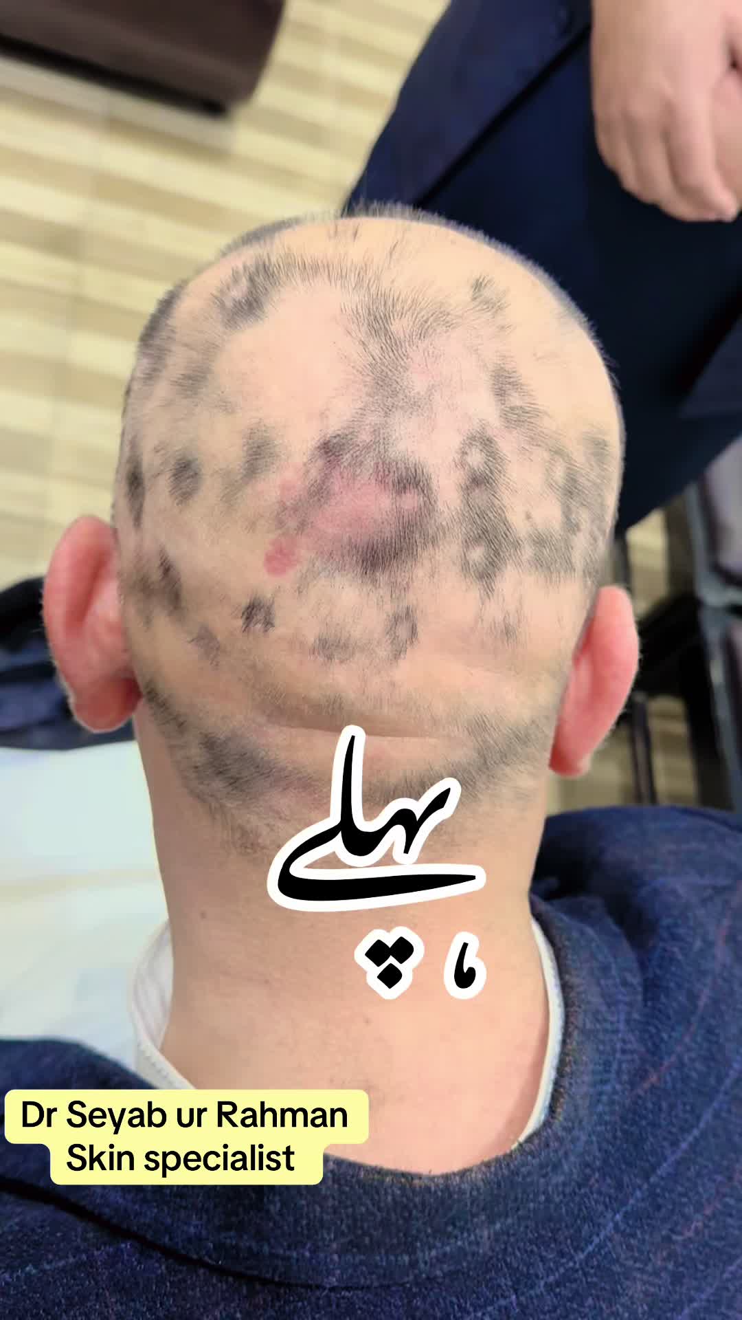 @Dr seyab Dermatologist
