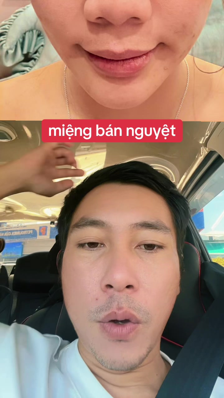 @Tuệ Nh&atilde;n ✅