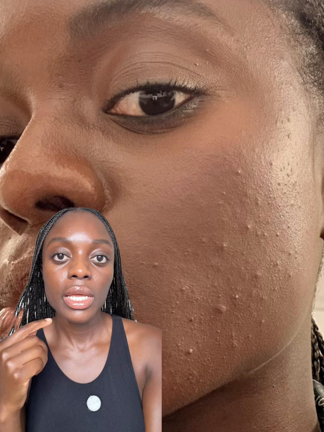 @Dr Awo