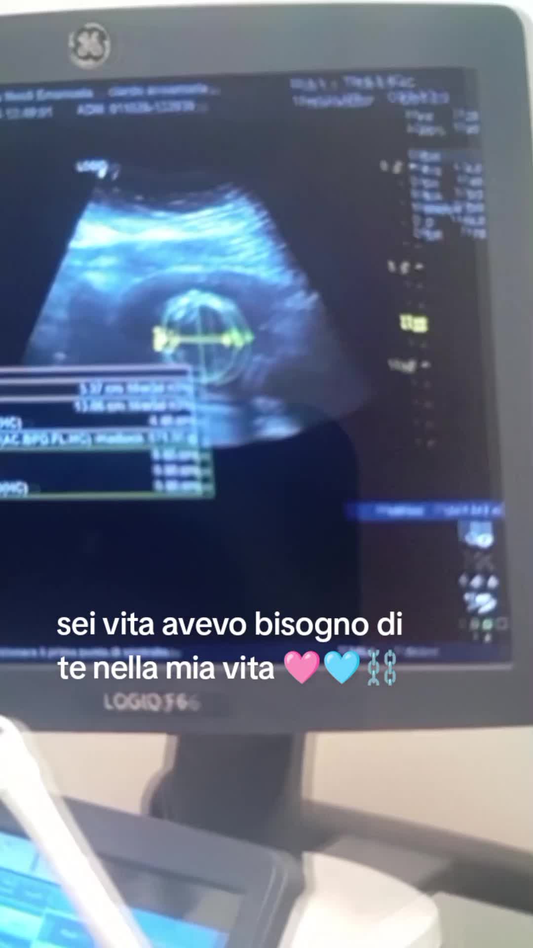 @Annare e Antonio🖤🔗