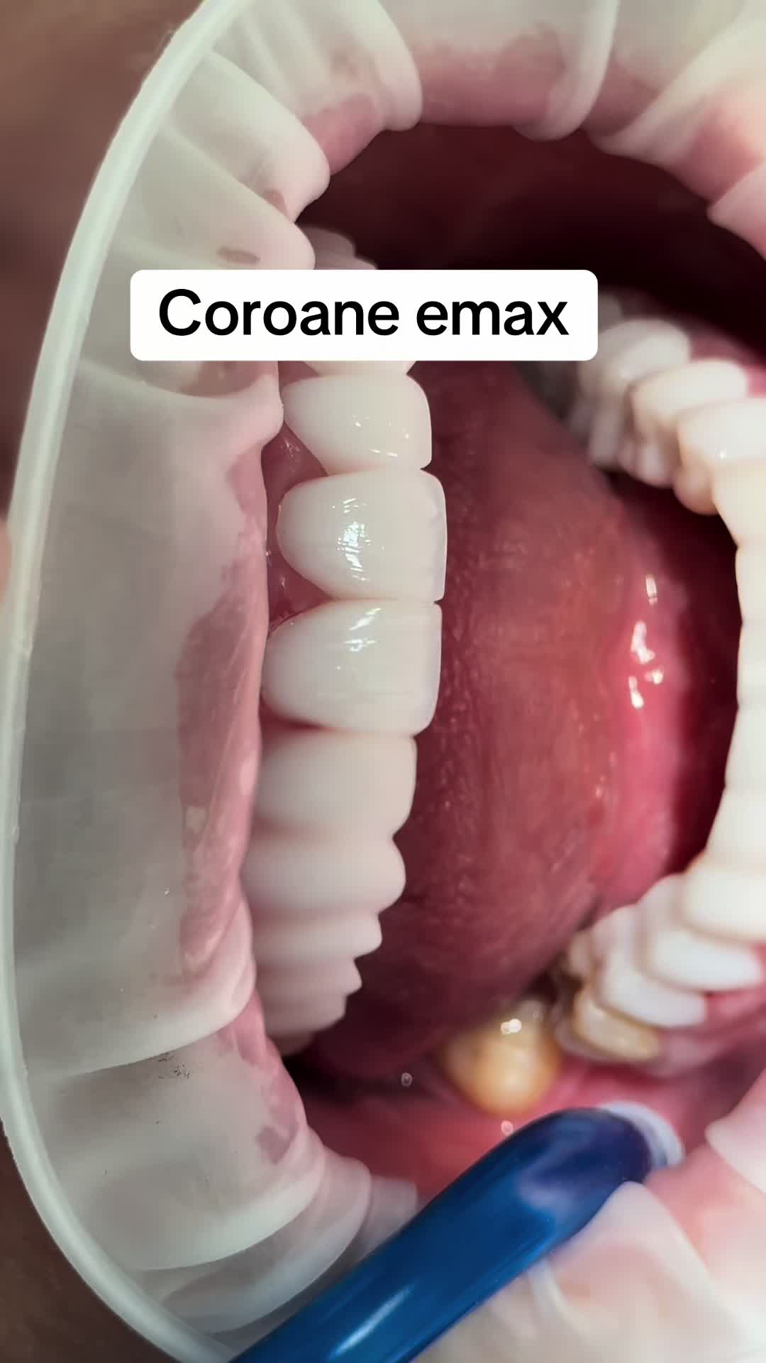@DR.OMAR