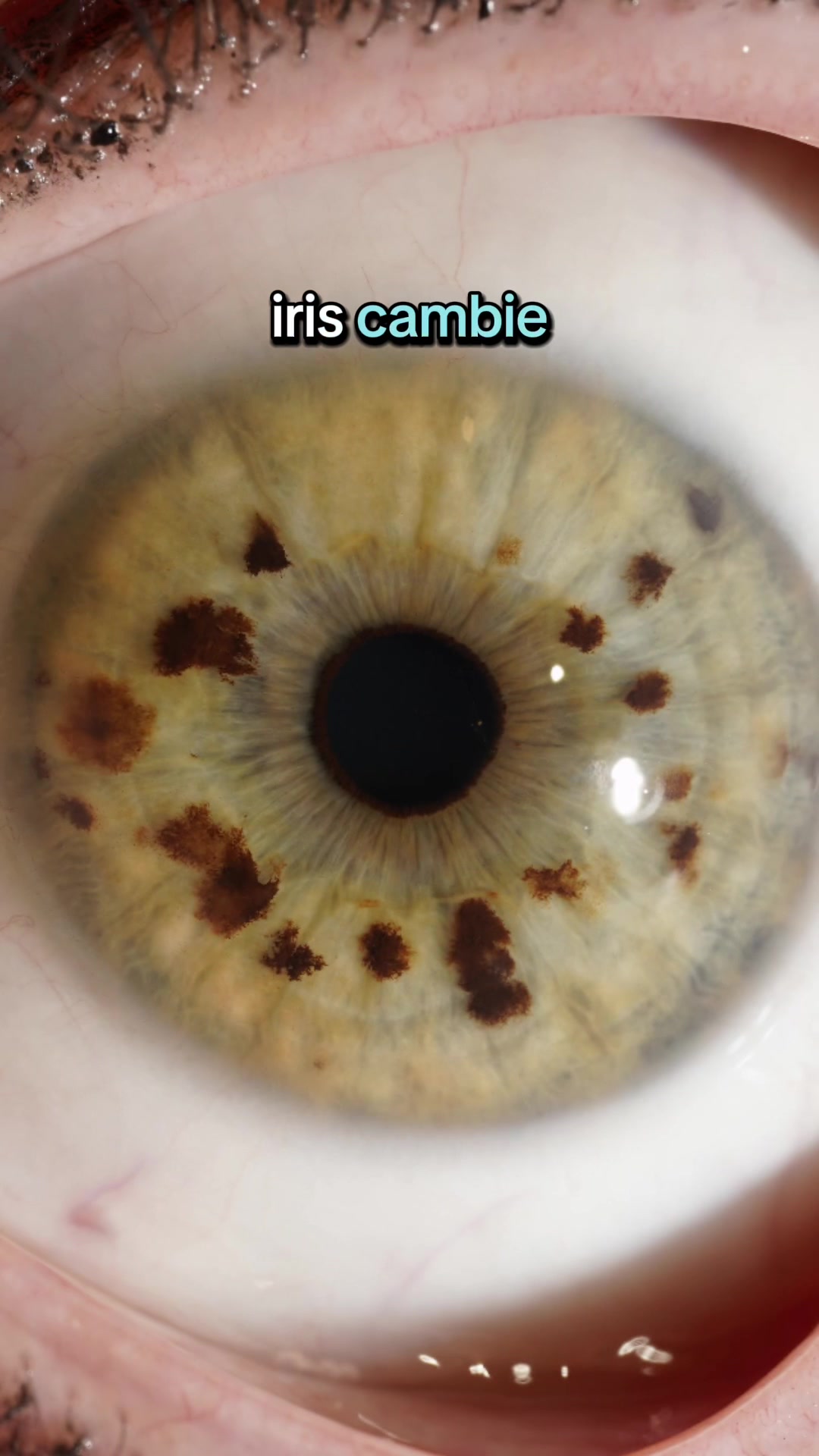 @EyesHunter